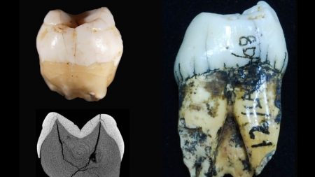 Ilustrasi: Gigi homo sapiens (kiri) dan gigi orangutan (kanan)/Tanya Smith dan Rokus Awe Due 