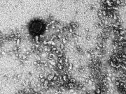 Ilustrasi: Virus COVID-19 dipotret dengan dengan mikroskop/Rospotrebnadzor/TASS