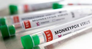 Ilustrasi sampel virus Monkeypox - Reuters