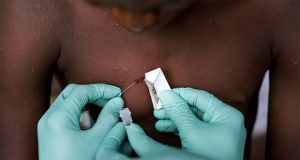 Pemeriksaan penyakit cacar monyet atau monkeypox di Kongo - GettyImages