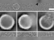 Tampilan porcine cytomegalovirus melalui mikroskop elektron. (Sumber: SpringerLink)