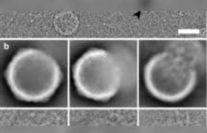 Tampilan porcine cytomegalovirus melalui mikroskop elektron. (Sumber: SpringerLink)