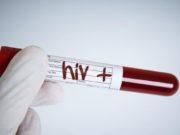 Sejarah dan Perkembangan HIV/AIDS di Dunia dan Indonesia